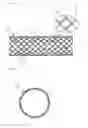 Fig. 02 - WAVILY DEFORMABLE STENT AND METHOD FOR PRODUCING THE SAME