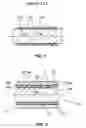 Fig. 02 - IMPLANT, METHOD AND DEVICE FOR PRODUCING AN IMPLANT OF THIS TYPE
