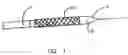 Fig. 02 - Endoprostheses and methods of manufacture