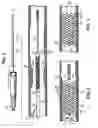 Fig. 02 - Locking polymer stents