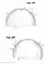 Fig. 09 - Device for regulating blood flow