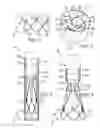 Fig. 02 - Multipiece prosthetic mitral valve and method