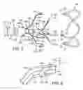 Fig. 03 - Multipiece prosthetic mitral valve and method