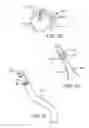 Fig. 17 - Multipiece prosthetic mitral valve and method