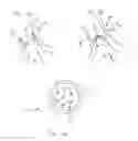 Fig. 02 - PROSTHETIC HEART VALVES, SUPPORT STRUCTURES AND SYSTEMS AND METHODS FOR  IMPLANTING THE SAME,