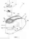 Fig. 02 - Method of installation of intervertebral spacers