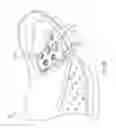 Fig. 35 - Shoes, devices for shoes, and methods of using shoes