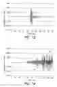 Fig. 08 - Apparatus for attenuating ultrasonic waves propagating within a pipe wall