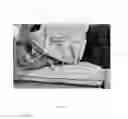 Fig. 09 - DEVICE AND METHOD FOR PREVENTING OR REDUCING SNORING AND/OR SLEEP APNEA