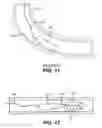 Fig. 08 - Slickline conveyed debris management system