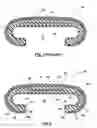 Fig. 02 - Modified handrail