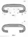 Fig. 03 - Modified handrail