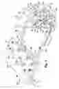 Fig. 04 - Method and device for restraining movement of continuously traveling glass sheet