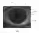 Fig. 09 - Ocular surface interferometry (OSI) methods for imaging, processing, and/or displaying an ocular tear film