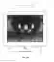Fig. 35 - Ocular surface interferometry (OSI) methods for imaging, processing, and/or displaying an ocular tear film