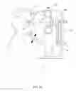 Fig. 02 - Orthovoltage radiotherapy