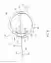 Fig. 04 - Orthovoltage radiotherapy