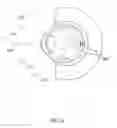 Fig. 22 - Orthovoltage radiotherapy