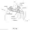Fig. 30 - Orthovoltage radiotherapy