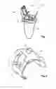 Fig. 02 - Hearing instrument and input method for a hearing instrument