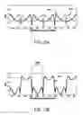 Fig. 12 - Magnetic resonance imaging with fat suppression by combining phase rotating data with phase shifted data in K-space