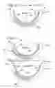 Fig. 07 - Thrust washer and radial/axial bearing having such a thrust washer