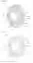 Fig. 06 - DISCHARGE VALVE FOR LINEAR COMPRESSOR