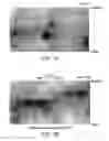 Fig. 02 - Vimentin Directed Diagnostics And Therapeutics For Multidrug Resistant Neoplastic Disease