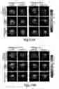 Fig. 13 - Nanoparticles for brain tumor imaging