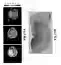 Fig. 23 - Nanoparticles for brain tumor imaging