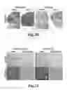 Fig. 24 - Nanoparticles for brain tumor imaging