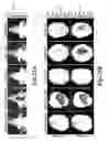 Fig. 27 - Nanoparticles for brain tumor imaging