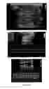 Fig. 07 - Methods for producing a non human model for aortic aneurysm