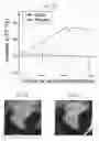 Fig. 09 - Therapy using cardiac stem cells and mesenchymal stem cells