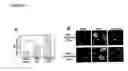 Fig. 09 - ROLE FOR SRY IN PARKINSON'S DISEASE