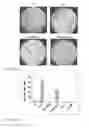 Fig. 16 - Anti aging agents and methods to identify them
