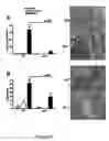 Fig. 03 - REGULATING IL-4 AND IL-13 LEVELS BY BLOCKING HIGH AFFINITY BINDING BY IL-3, IL-5 AND GM-CSF TO THEIR COMMON RECEPTOR
