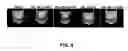 Fig. 09 - Modulation of platelet aggregation