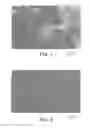 Fig. 02 - REMINERALIZING COMPOSITIONS AND METHODS