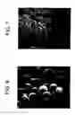 Fig. 06 - Delivery of AS-oligonucleotide microspheres to induce dendritic cell tolerance for the treatment of autoimmune type 1 diabetes