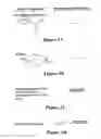 Fig. 02 - Nucleic acid anchoring system comprising covalent linkage of an oligonucleotide to a solid support