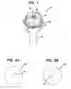 Fig. 02 - Surgical Access Device with One Time Seal