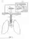 Fig. 02 - System and method for determining placement of a tracheal tube