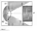 Fig. 04 - METHODS AND DEVICES FOR ENDOSCOPIC IMAGING