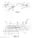 Fig. 02 - Medical fluid delivery system