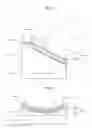 Fig. 04 - Separable Biopsy Device Integrated-Type Ultrasonic Diagnostic Apparatus