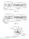 Fig. 07 - PROBE APPARATUS FOR RECOGNIZING ABNORMAL TISSUE