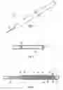 Fig. 02 - Pre-Filled Plunger System and Method