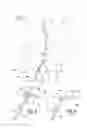 Fig. 02 - Guide device for introducing at least a surgical instrument internally of an organic cavity, in particular a vascular cavity
