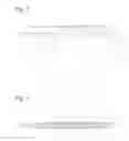 Fig. 04 - Spiral balloon catheter